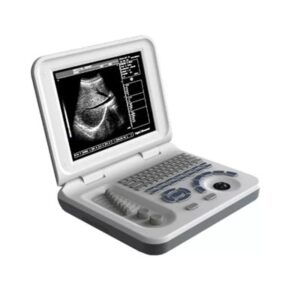 PT-300 LED Portable Ultrasound Scanner